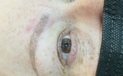 Healed micro bladed brow