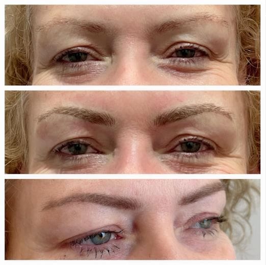 Microbladed Brow Stages